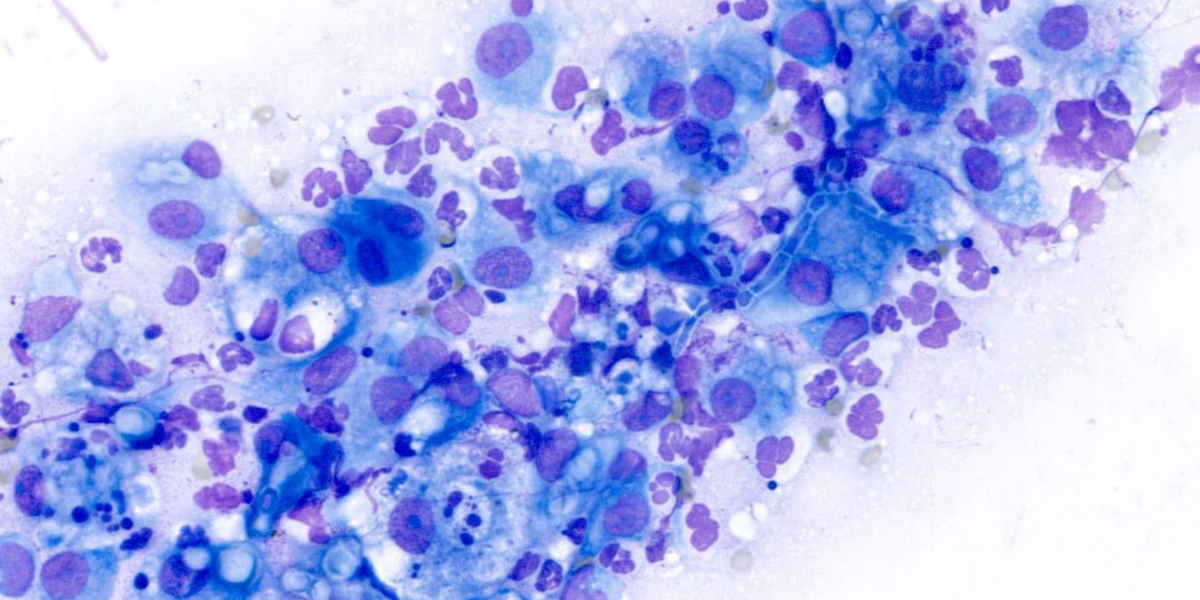 Digital cytology: possible Cryptococcosis in a 10-year-old domestic ...