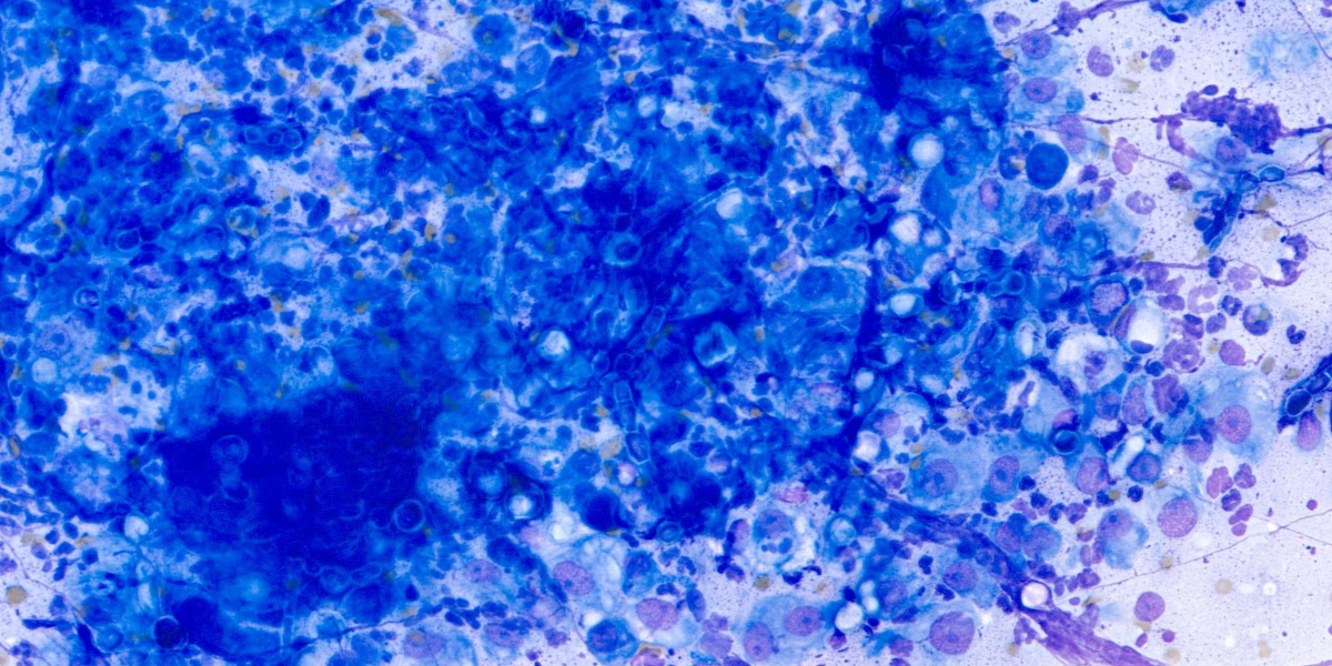 Digital cytology: possible Cryptococcosis in a 10-year-old domestic shorthair cat